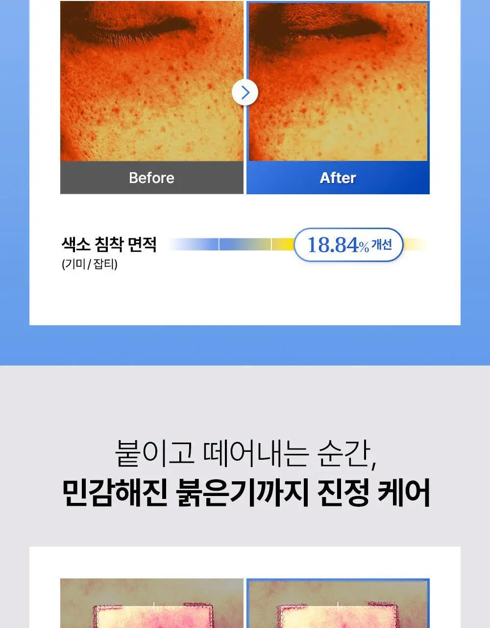 [리뉴얼/원조패드]코스알엑스 원스텝 패드 100매 4종 중 택1 상세페이지 126